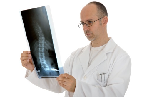 Skolioosi tarkoittaa selän ja selkärangan sivusuuntaista käyristyneisyyttä eli kieroselkäisyyttä. 